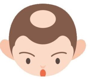 後頭部　初期脱毛